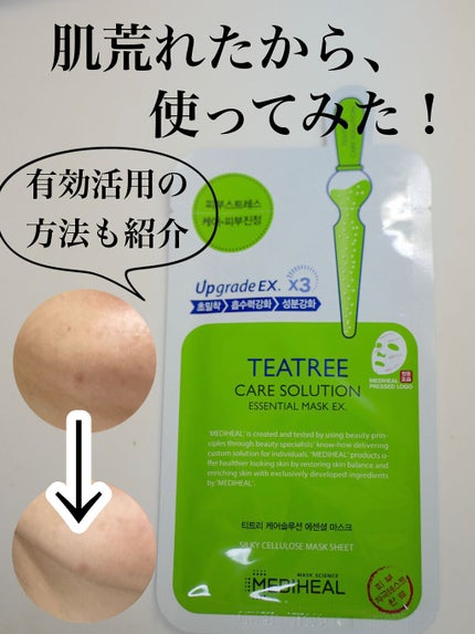 ティーツリーケア ソリューション エッセンシャルマスクEX/MEDIHEAL/シートマスク・パックを使ったクチコミ(1枚目)