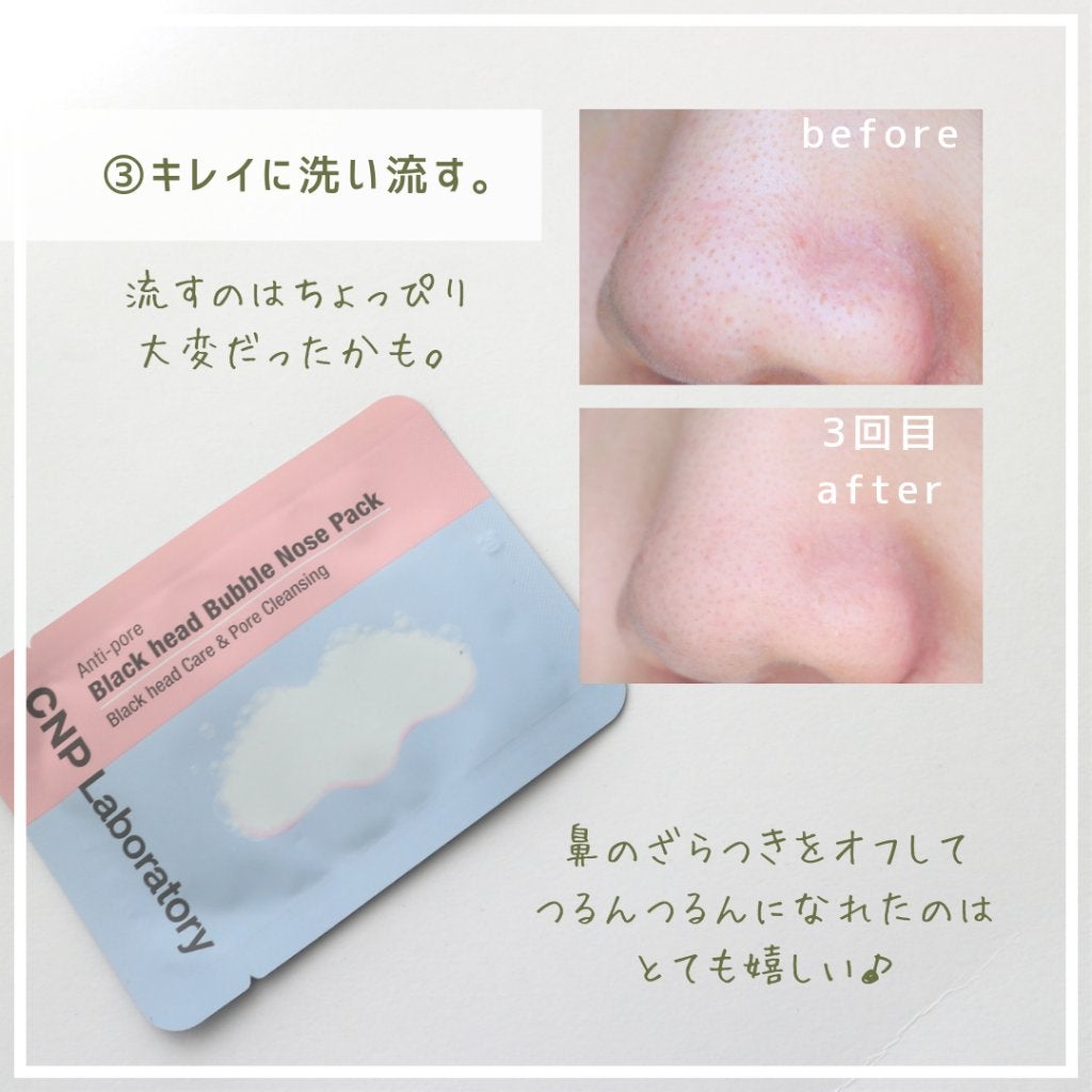 鼻 バブルパック/CNP Laboratory/シートマスク・パックを使ったクチコミ(4枚目)