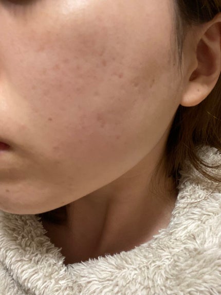 モイスチャー ミストローションII(しっとり)/アルージェ/ミスト状化粧水を使ったクチコミ(4枚目)