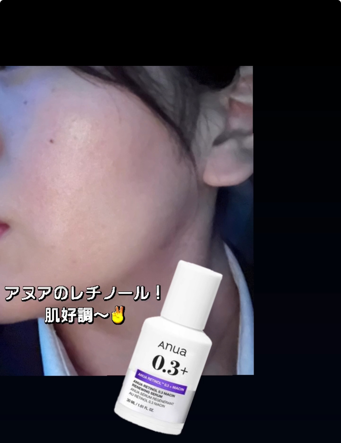 ヒルメナイド油性クリーム（医薬品）/matsukiyo/その他を使ったクチコミ（1枚目）