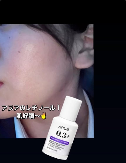 ヒルメナイド油性クリーム(医薬品)/matsukiyo/その他を使ったクチコミ(1枚目)