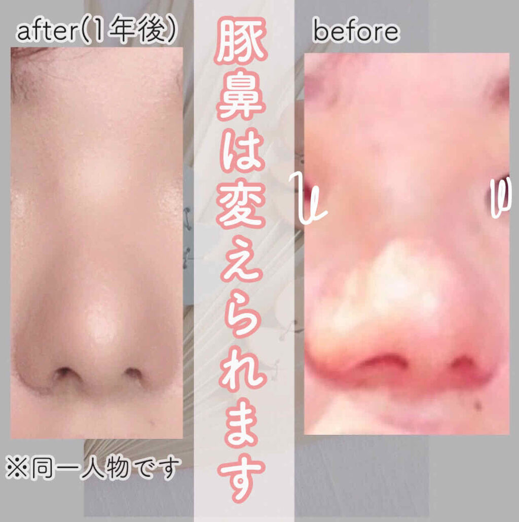 THREE シマリング グロー デュオ/THREE/クリームハイライトを使ったクチコミ（1枚目）