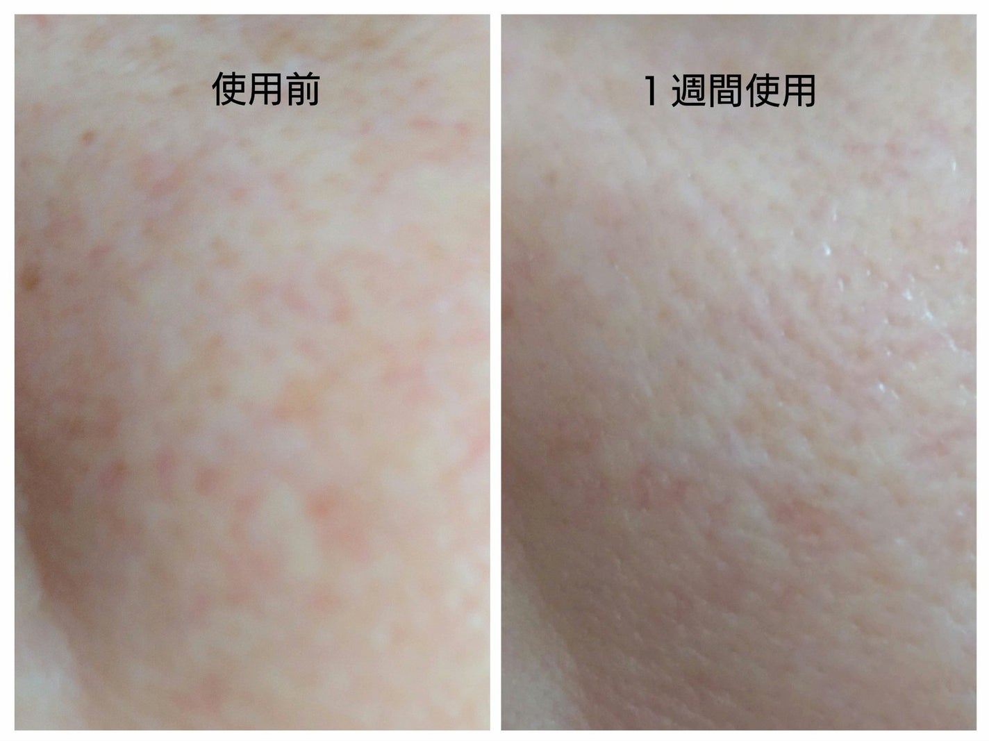 PDRNショット675/COSNORI/美容液を使ったクチコミ(5枚目)