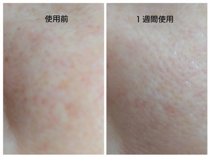 PDRNショット675/COSNORI/美容液を使ったクチコミ(5枚目)