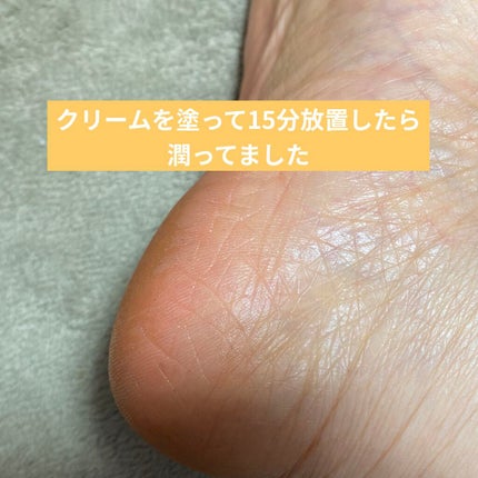 かかとちゃん/桐灰化学/レッグ・フットケアを使ったクチコミ(5枚目)