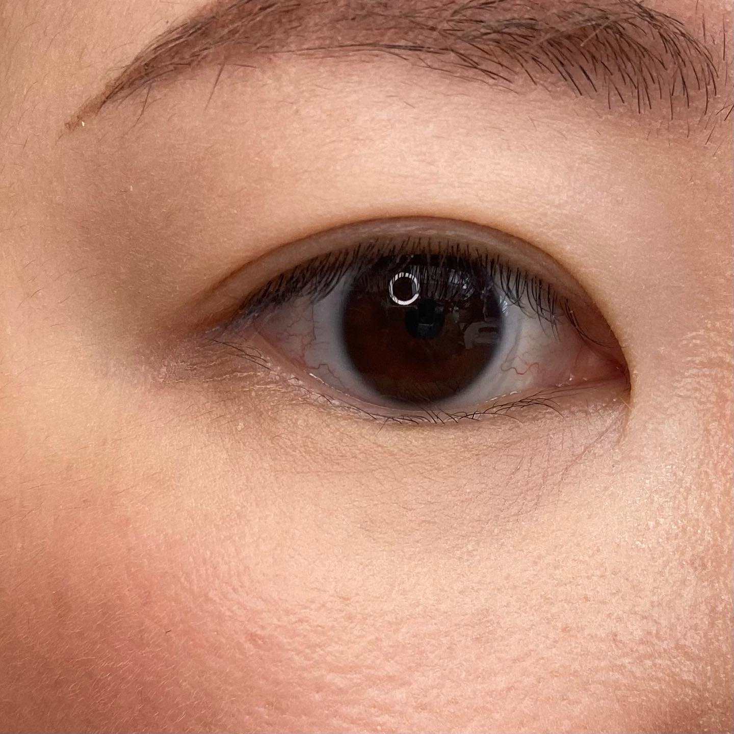 ロングラスティングチップコンシーラーフィックシングフィット/LUNA/リキッドコンシーラーを使ったクチコミ（3枚目）