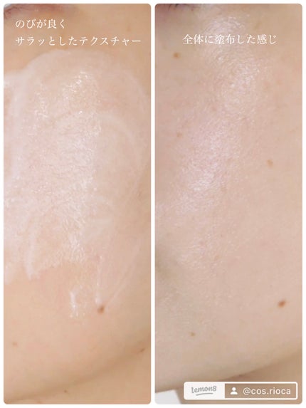 セルフホワイトニング ミッション/ALBION/美容液を使ったクチコミ(5枚目)