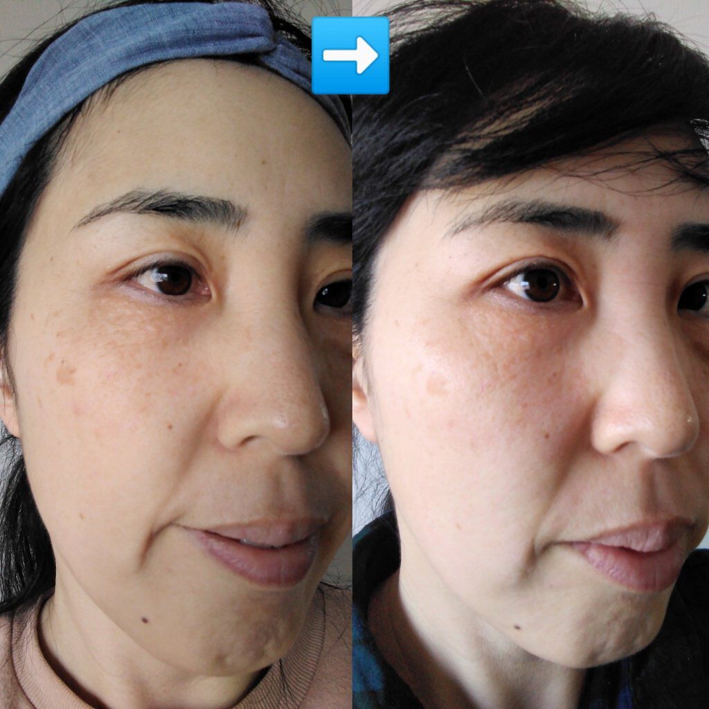 引き算パック/natural forme/洗い流すパック・マスクを使ったクチコミ（2枚目）