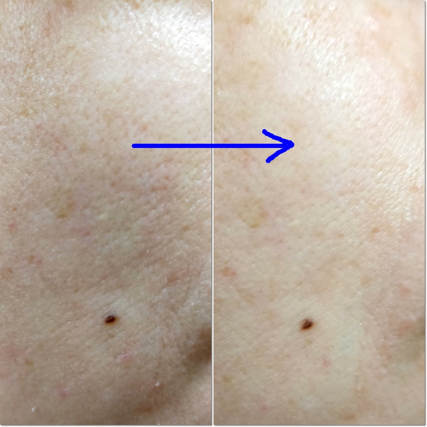 ゼロ1DAYエクソソームショット2000/MEDICUBE/美容液を使ったクチコミ(4枚目)