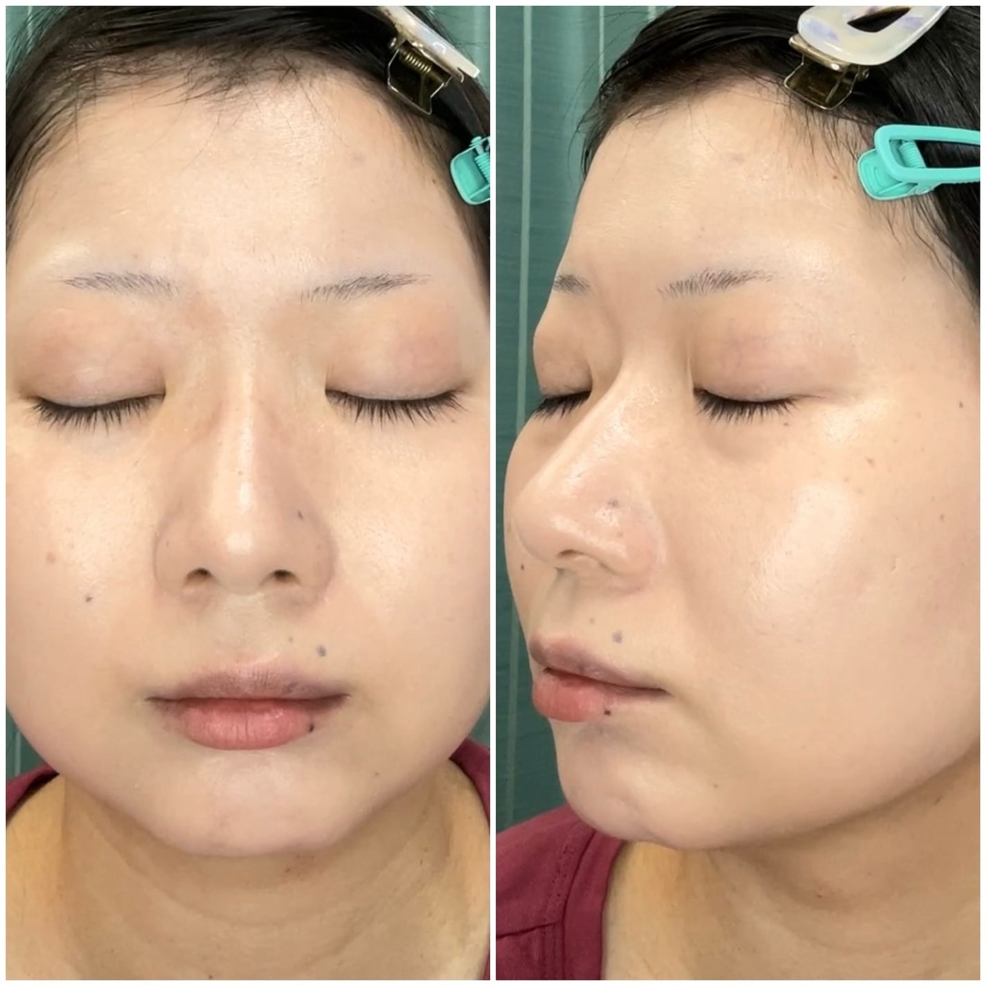 グレーズ ウォータリング クッション/athé/クッションファンデーションを使ったクチコミ(5枚目)