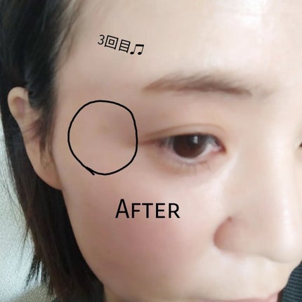 シーヴァ Grangrade薬用美白シミキールパックS のクチコミ「
株式会社シーヴァ様の
✨グラングレイ 薬用美白シミキールパックS✨
薬用美白吸着パッ.....」(3枚目)