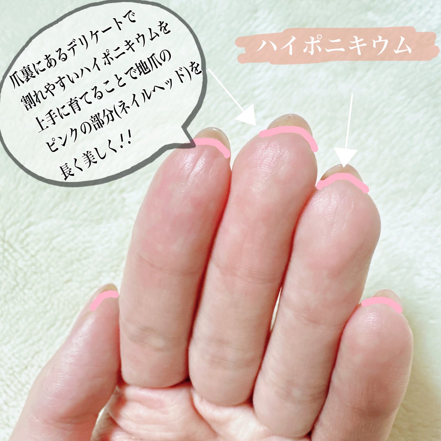 ドロップリペアセラム/ネイルネイル/ネイルオイル・トリートメントを使ったクチコミ(2枚目)