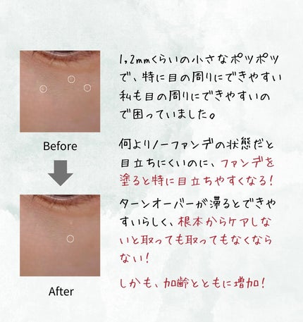 薬用クリア化粧水/メンソレータム アクネス/化粧水を使ったクチコミ(3枚目)