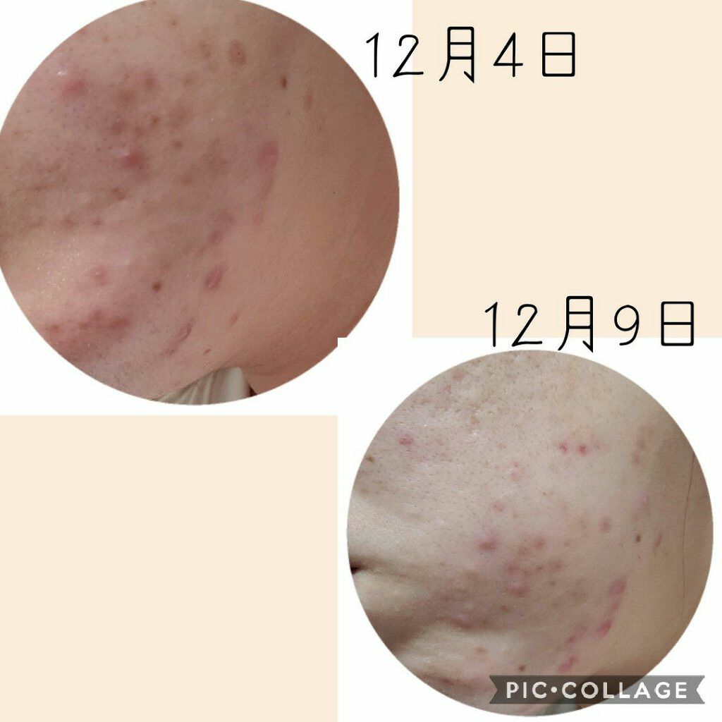 楽園/ラッシュ/フェイスクリームを使ったクチコミ(2枚目)