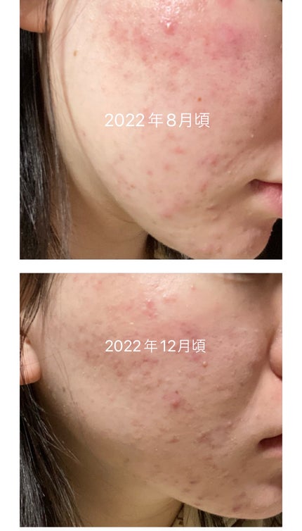 トーンショットクリーム/アバンタイム/フェイスクリームを使ったクチコミ(3枚目)