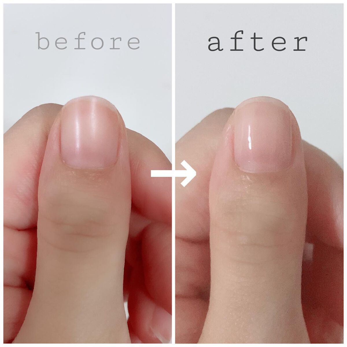 自爪補強コート/デュカート/ネイルベースコートを使ったクチコミ（3枚目）