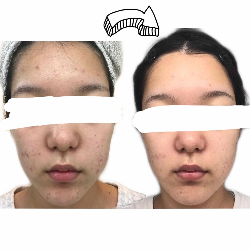 ホホバオイル/無印良品/ボディオイルを使ったクチコミ(2枚目)