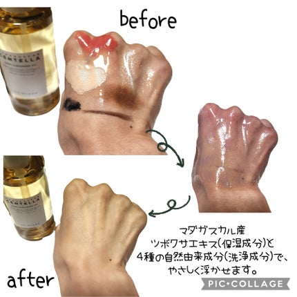 センテラ ライトクレンジングオイル/SKIN1004/オイルクレンジングを使ったクチコミ(4枚目)