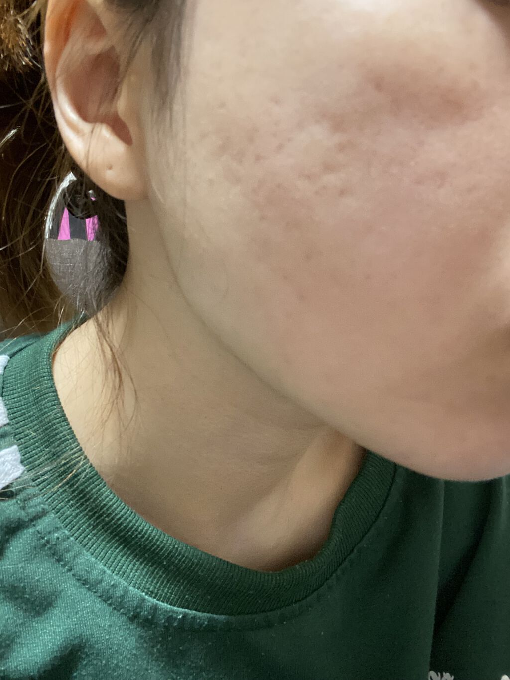 ホワイトニング エッセンス/アルージェ/美容液を使ったクチコミ（2枚目）