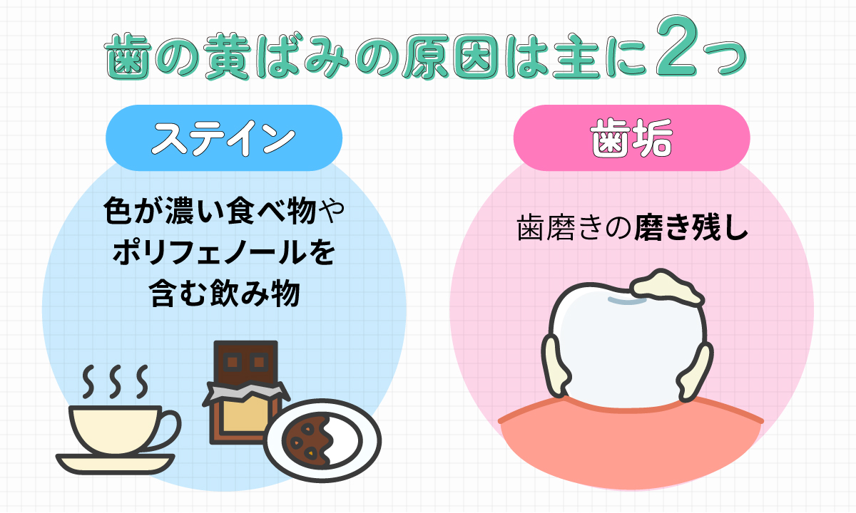 歯の黄ばみの原因は主に2つ。ステインは色が濃い食べ物やポリフェノールを含む飲み物が原因。歯垢は歯磨きの磨き残し。