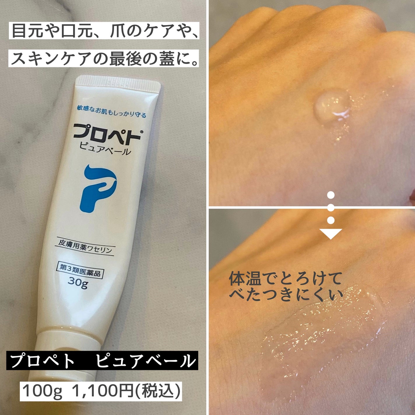 オロナインH軟膏 (医薬品)/オロナイン/その他を使ったクチコミ(3枚目)