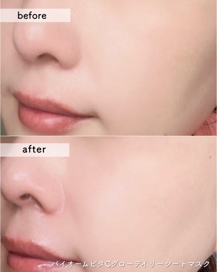 バイオームビタC黒クマアイパッチ/UIQ/シートマスク・パックを使ったクチコミ(4枚目)