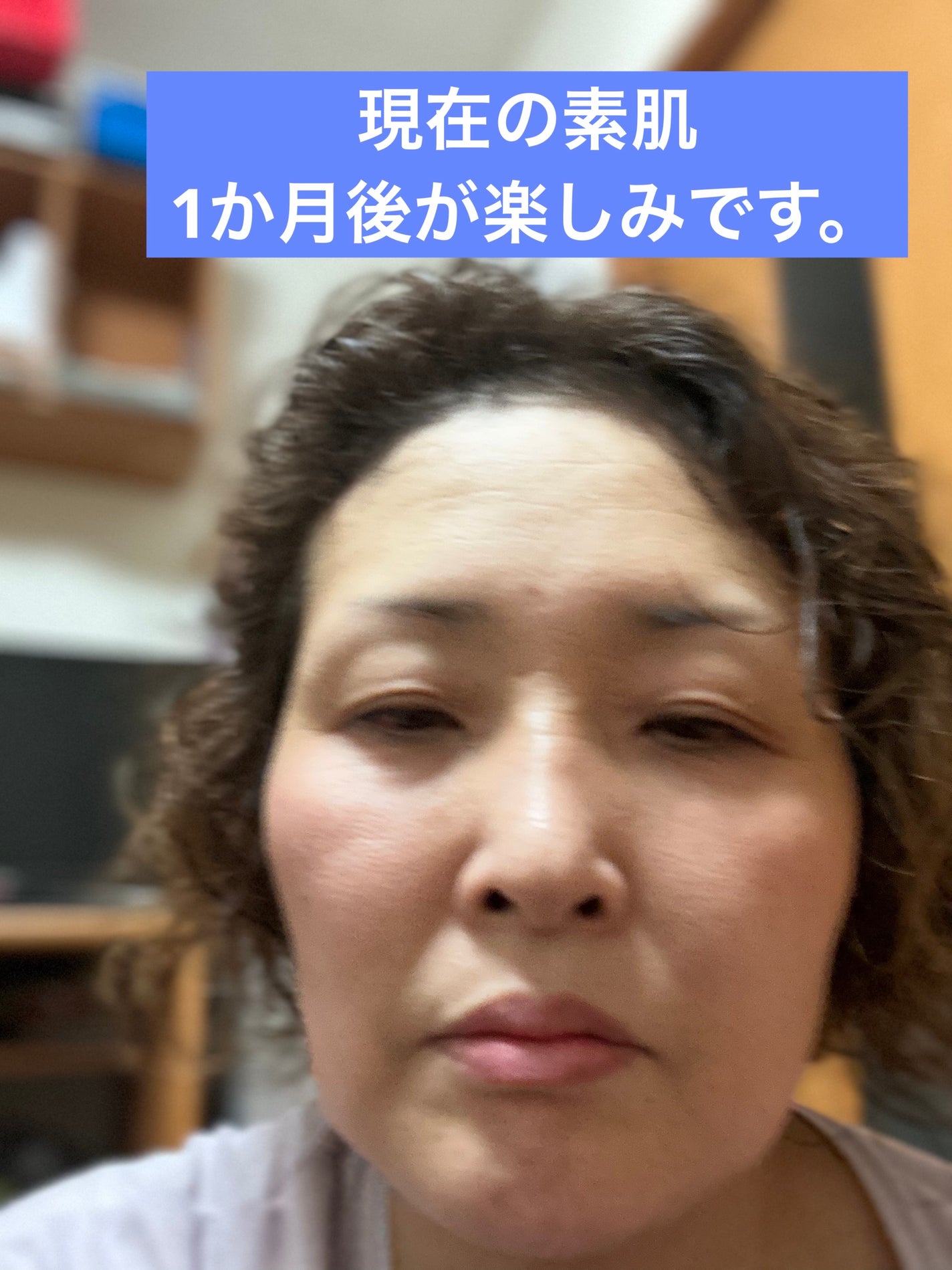 ハイドロキノン原液美容液/フィールドアンドデバイス/美容液を使ったクチコミ(3枚目)