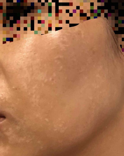 ドクタージャルト ソーラーバイオームアンプル/Dr.Jart+/美容液を使ったクチコミ(2枚目)