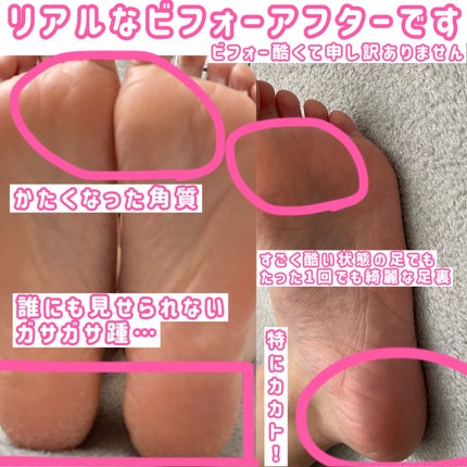 イージーパックDP60分タイプ/ベビーフット/レッグ・フットケアを使ったクチコミ(4枚目)