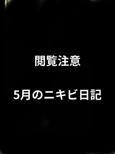 5月日記


こうして見るとあんまり変わらない気がする笑笑

今オードムーゲを買おうか迷ってます
使ってみてよかった〜って人はコメントしてくれると嬉しいです！！

#ニキビ_ニキビ跡 
#ニキビ
#可愛