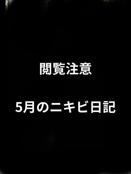 ベピオゲル/マルホ株式会社/その他を使ったクチコミ(1枚目)