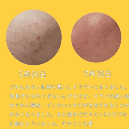 薬用 しみ 集中対策 美容液/メラノCC/美容液を使ったクチコミ(6枚目)