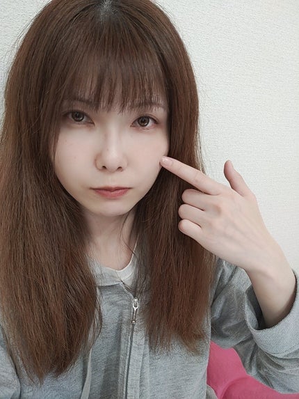 極薄透明パッチ nikipa!/金冠堂/にきびパッチを使ったクチコミ(3枚目)