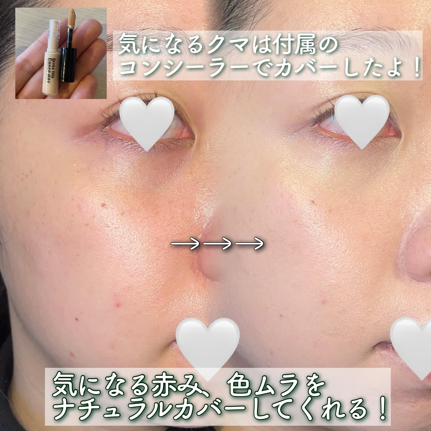ハートリーフシーンカバークッション/23years old/クッションファンデーションを使ったクチコミ（2枚目）