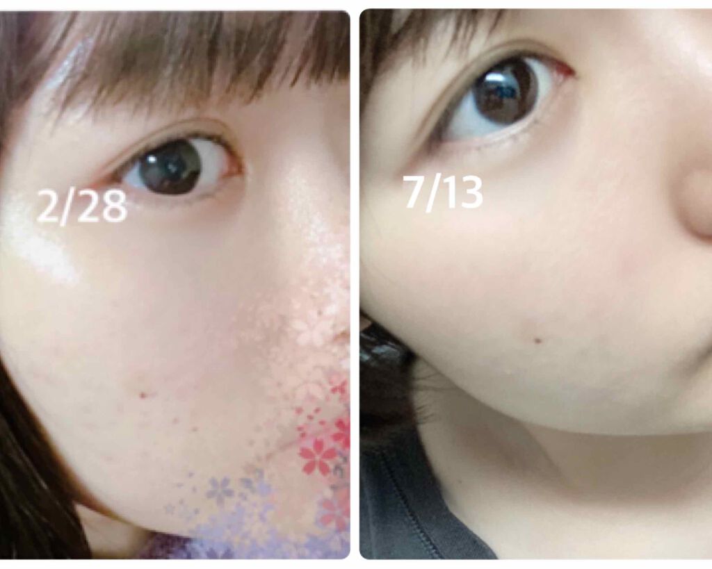 グリーンティーシード アイ＆フェイスボール/innisfree/美容液を使ったクチコミ（1枚目）