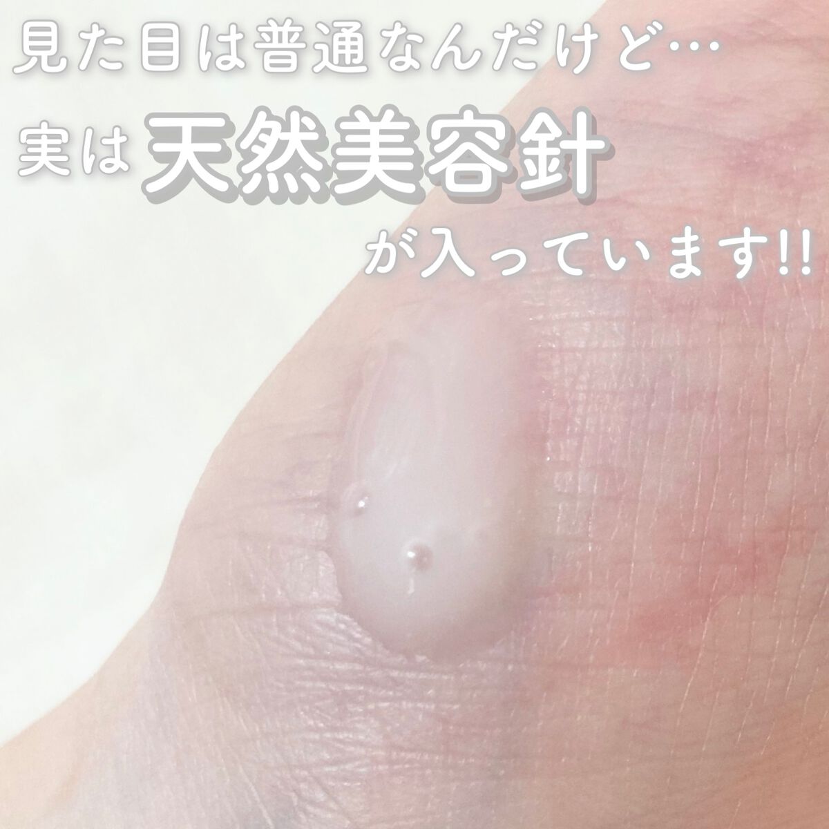 リードルショット100/VT/美容液を使ったクチコミ（2枚目）