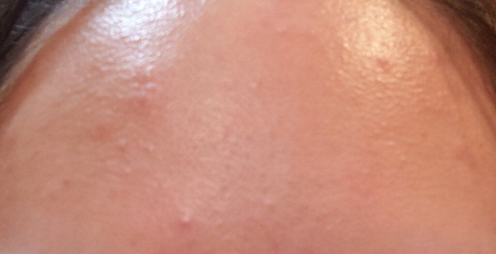 薬用しみ対策 美白化粧水/メラノCC/化粧水を使ったクチコミ（2枚目）