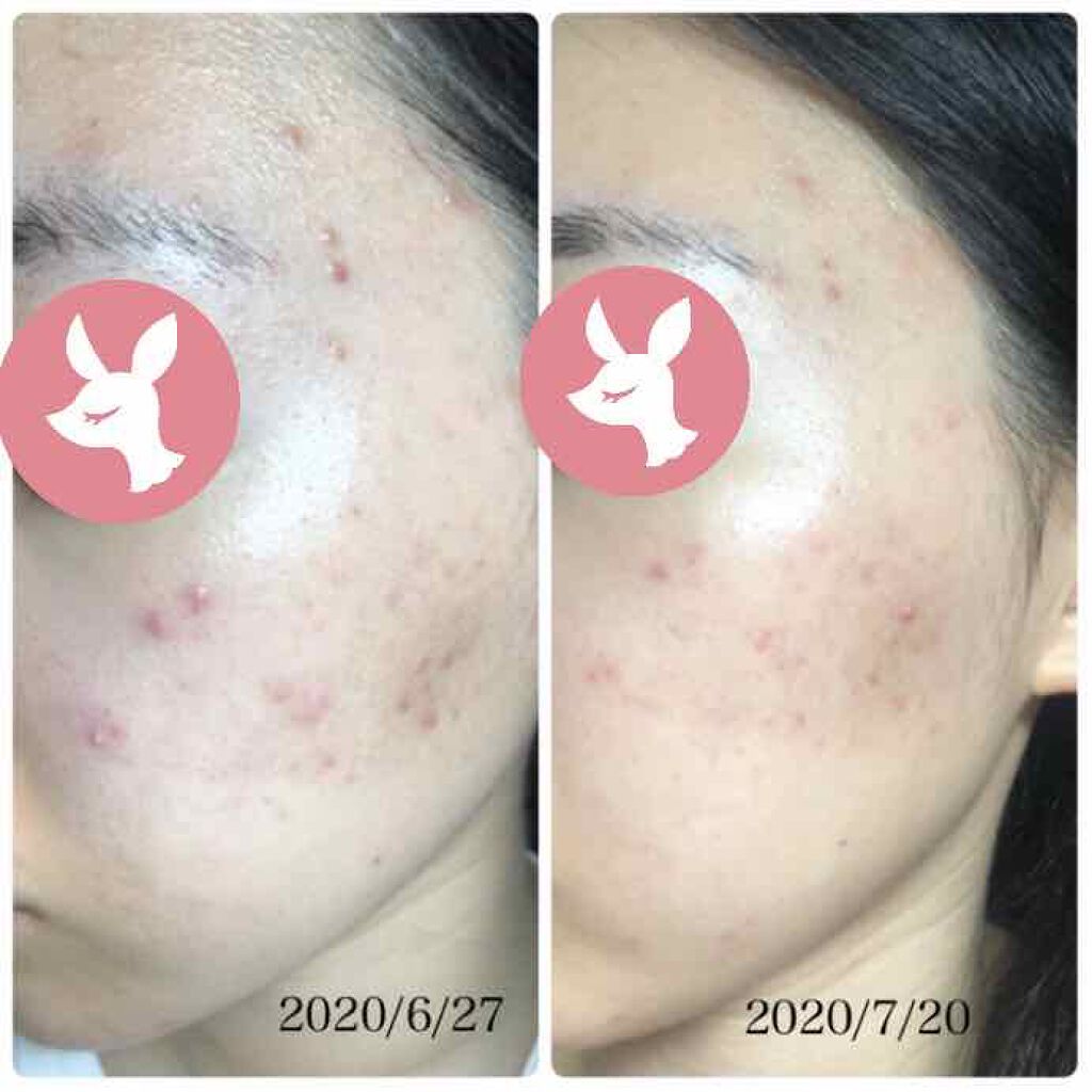 AC ウォッシングフォーム/NOV/洗顔フォームを使ったクチコミ(3枚目)