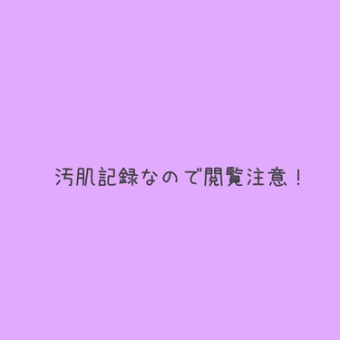 薬用クリアローション とてもしっとり/ネイチャーコンク/拭き取り化粧水を使ったクチコミ（2枚目）