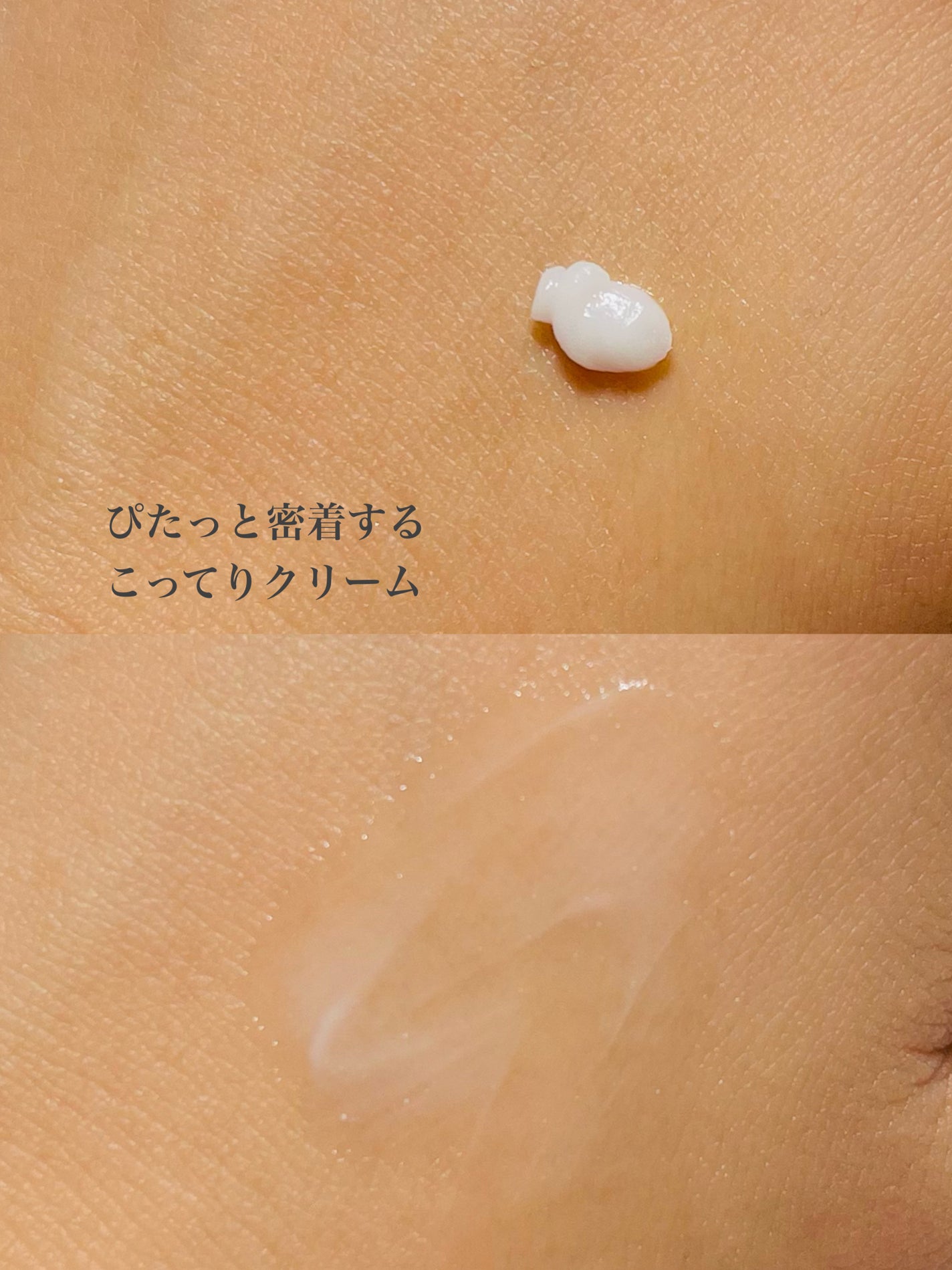 リンクルショット メディカル セラム N/リンクルショット/アイケア・アイクリームを使ったクチコミ(5枚目)