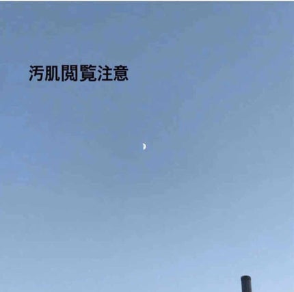 ハトムギ化粧水(ナチュリエ スキンコンディショナー R )/ナチュリエ/化粧水を使ったクチコミ(1枚目)