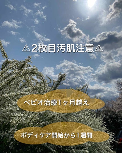 クナイプビオ オイル ローズ/クナイプ/ボディオイルを使ったクチコミ(1枚目)