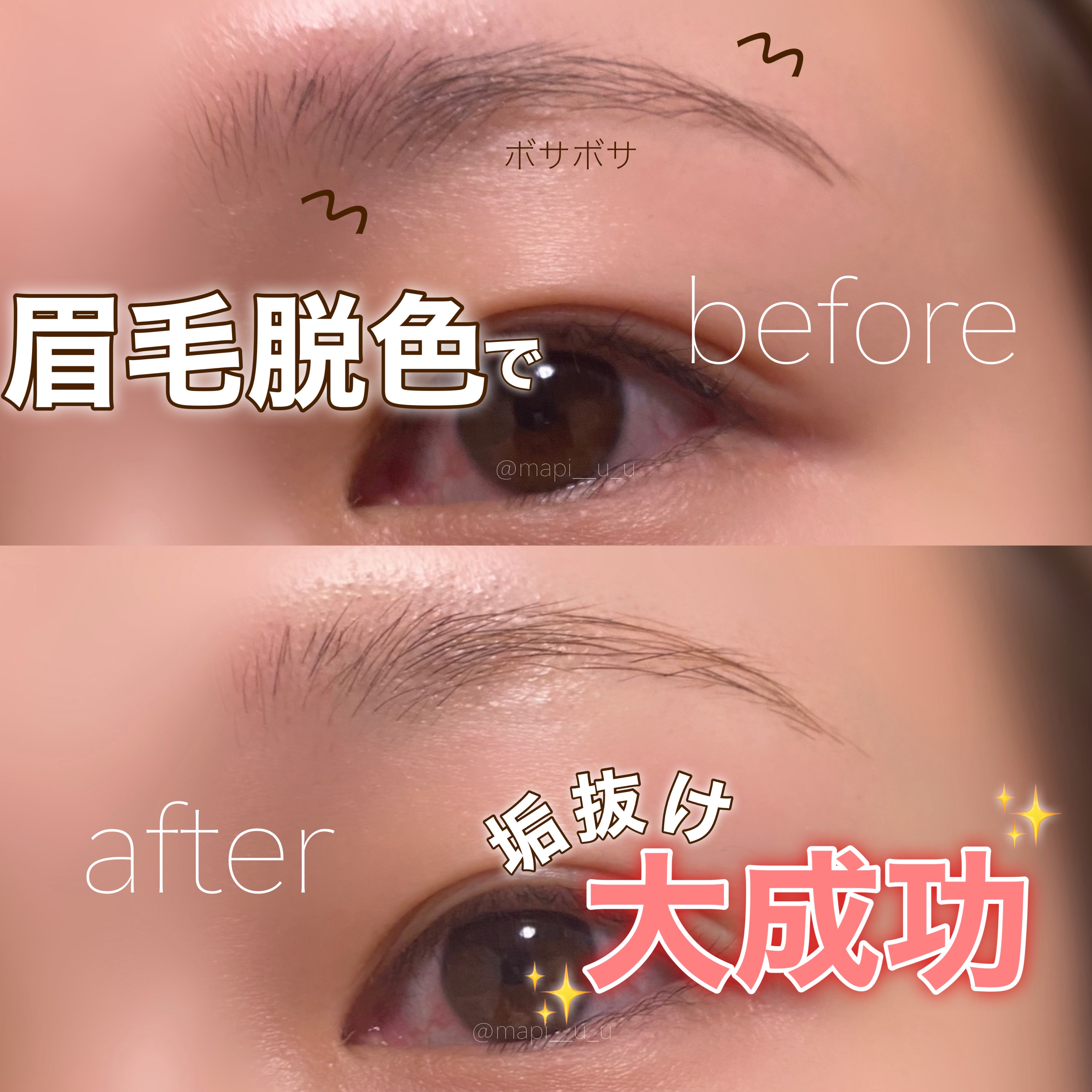 脱色クリーム 敏感肌用/エピラット/ムダ毛ケアを使ったクチコミ（1枚目）