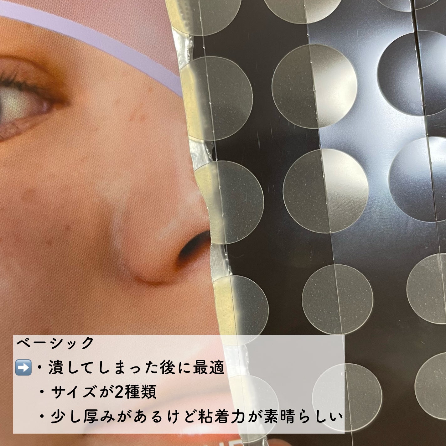 オニオン ニューペア スポットパッチ ベーシック/Isntree/にきびパッチを使ったクチコミ(3枚目)