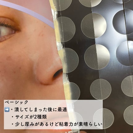 オニオン ニューペア スポットパッチ ベーシック/Isntree/にきびパッチを使ったクチコミ(3枚目)