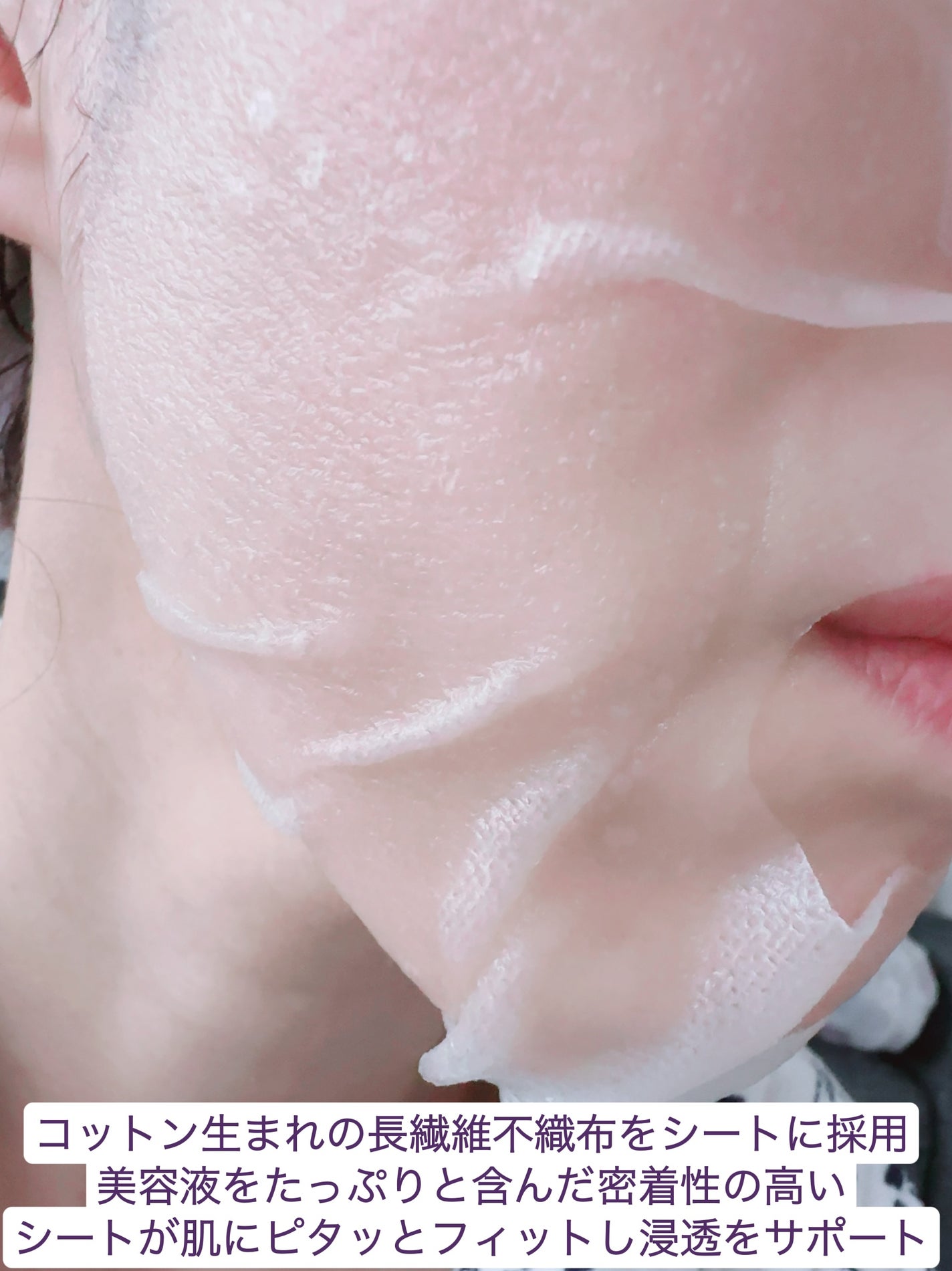 ダーマレーザー スーパーVC100+エクソソーム マスク/クオリティファースト/シートマスク・パックを使ったクチコミ(6枚目)