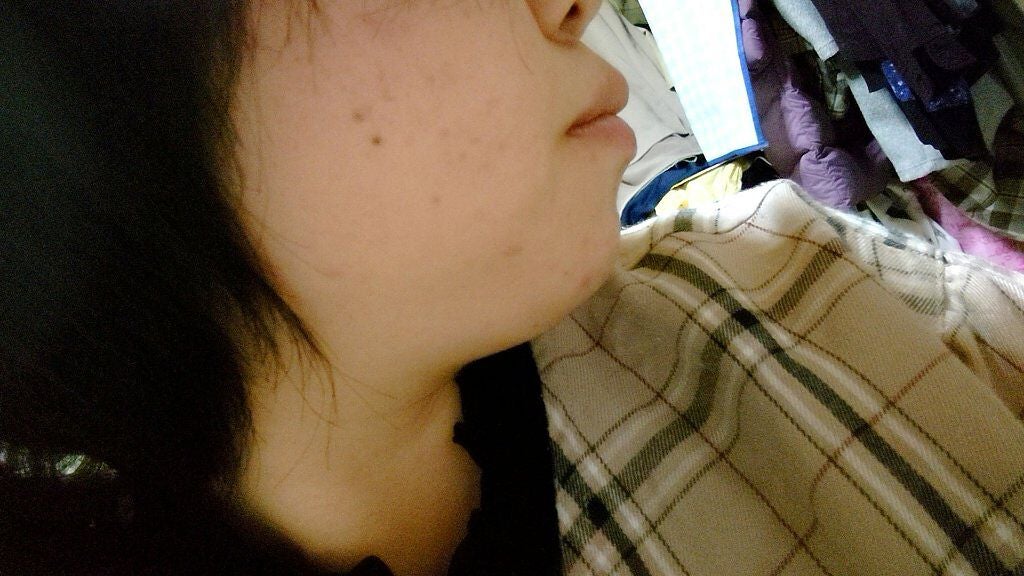 ハトムギ化粧水(ナチュリエ スキンコンディショナー R )/ナチュリエ/化粧水を使ったクチコミ(1枚目)