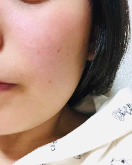 ホワイトニングクリア ローション/d プログラム/化粧水を使ったクチコミ(1枚目)