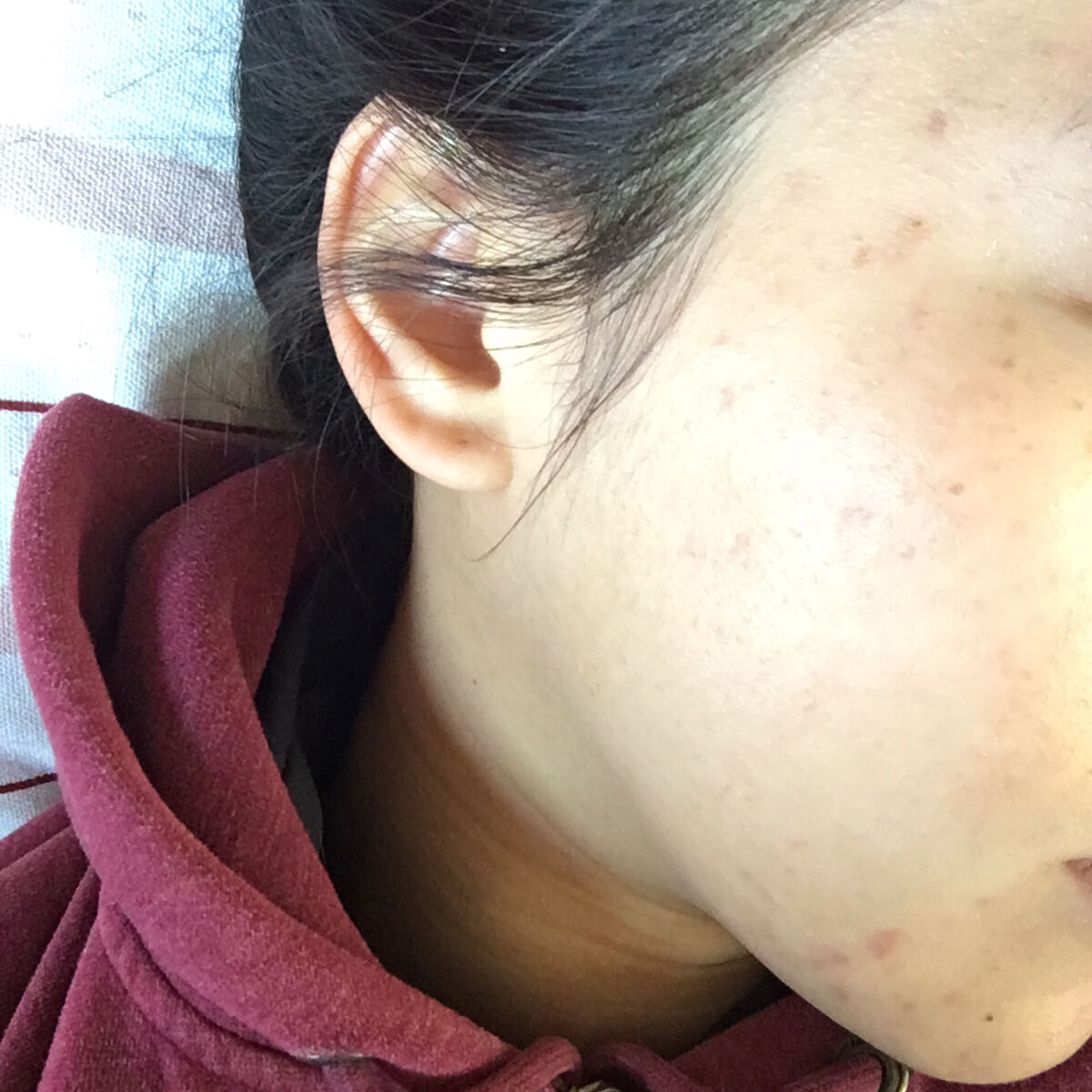 ラグジュアリーホワイト 薬用アクティブフォーミュラII/アンプルール/美容液を使ったクチコミ（1枚目）