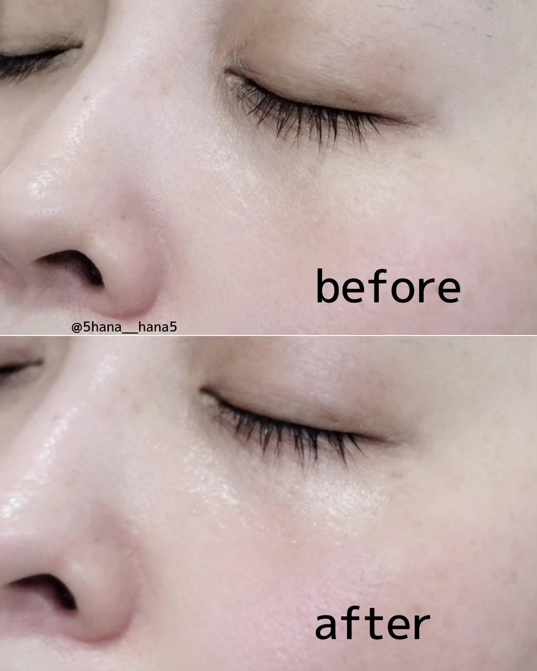 シルクセラム/エルツティン/美容液を使ったクチコミ(4枚目)